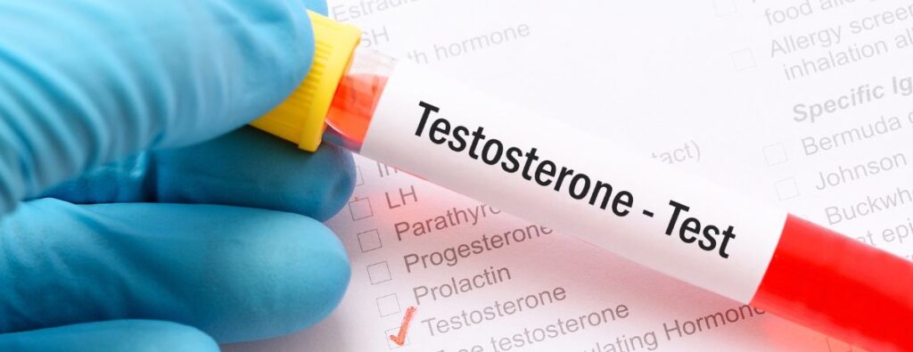 provetta da analizzare per verificare i livelli del testosterone